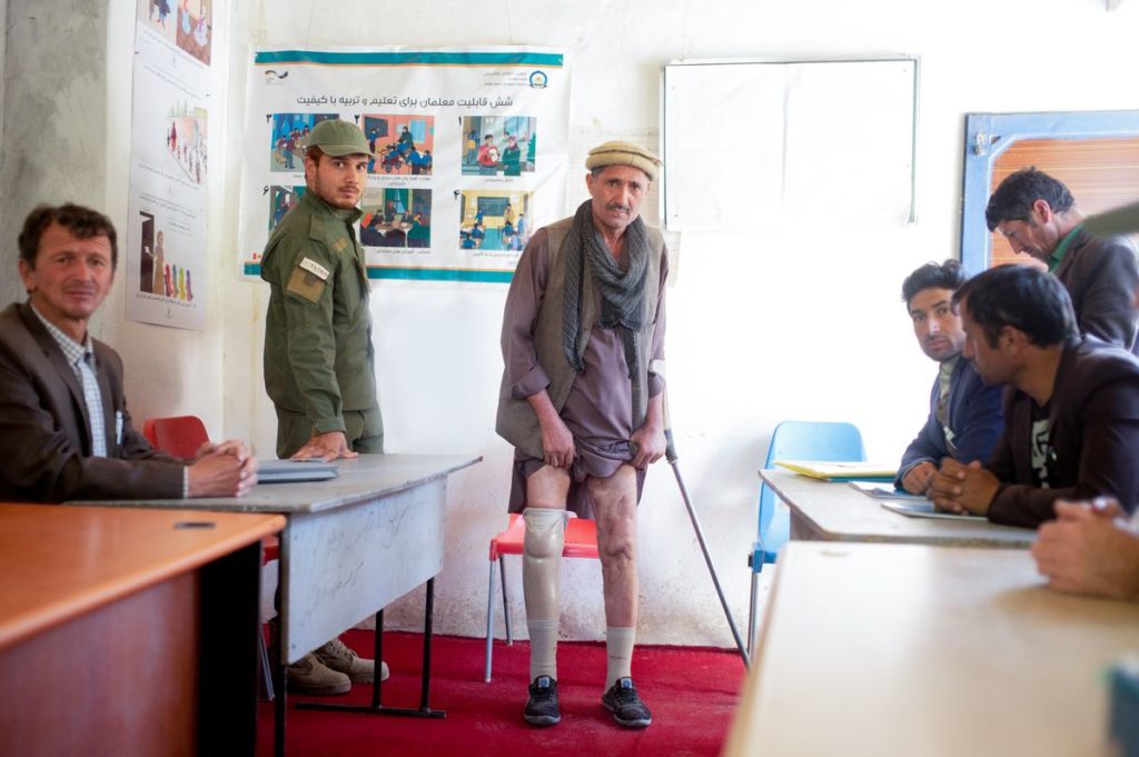 Mine accident survivor, Afghanistan